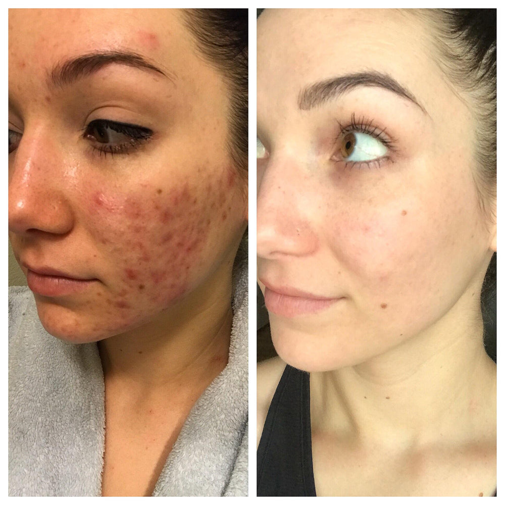 <h2><strong>These Women Took Back Their Confidence In 10 Minutes A Day</strong></h2>