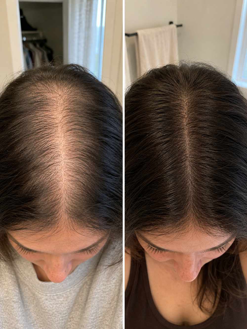 <h2>What postpartum hair recovery actually looks like.</h2>