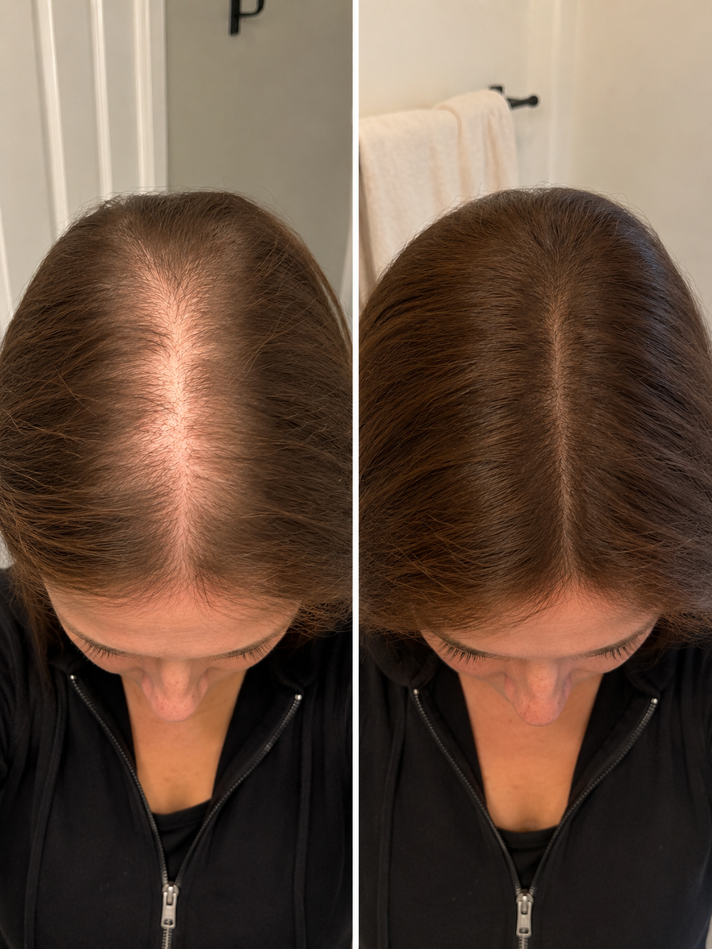 <h2>What postpartum hair recovery actually looks like.</h2>