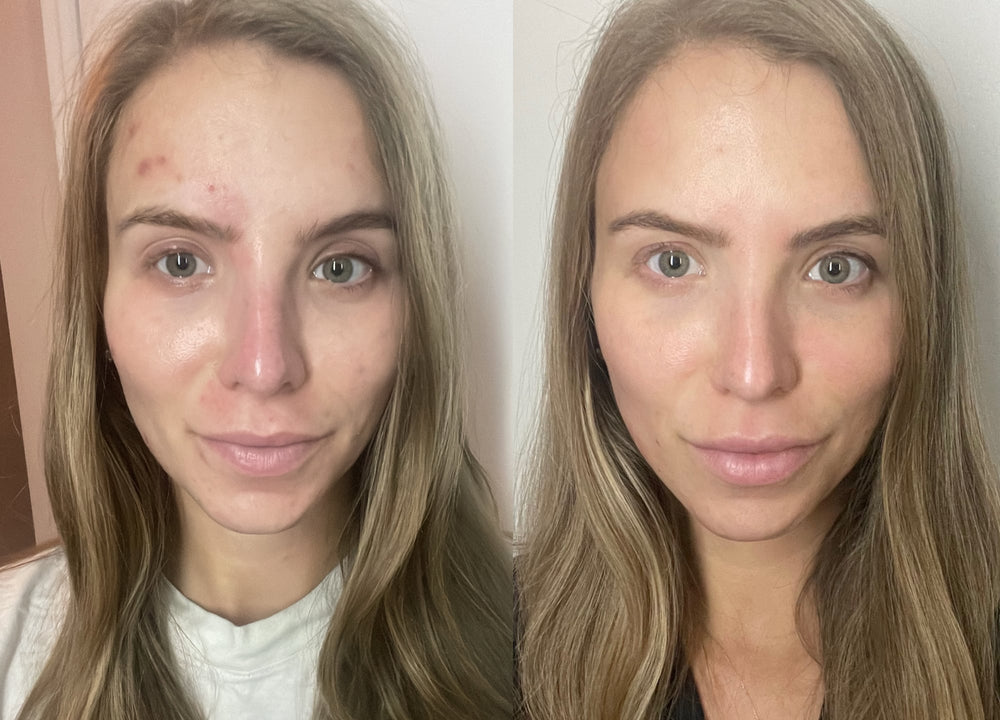 <h2><strong>These Women Took Back Their Confidence In 10 Minutes A Day</strong></h2>