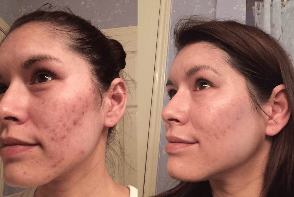 <h2><strong>These Women Took Back Their Confidence In 10 Minutes A Day</strong></h2>